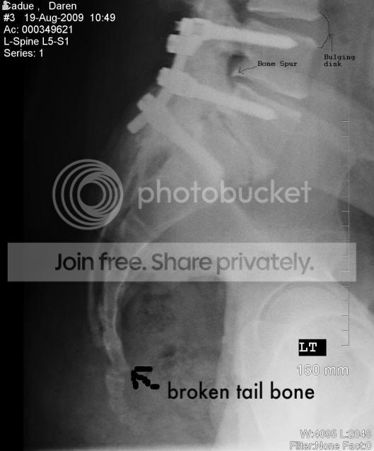 backx-ray-1.jpg