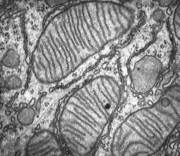 TEM%20mitochondria.jpg