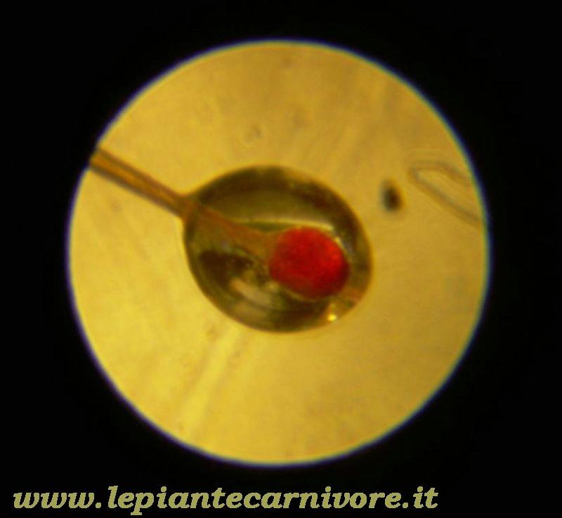 Micro%205%20D.Filiformis.jpg