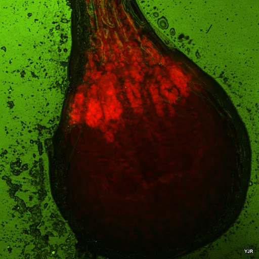 Drosera%20gland.jpg